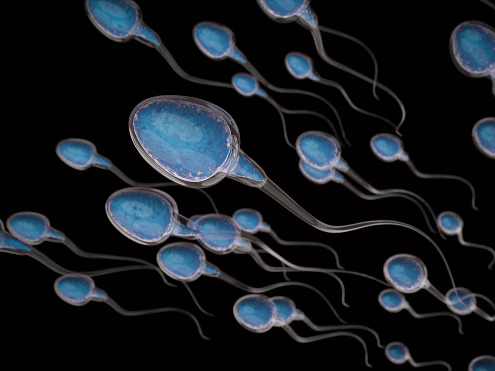 Sperma giallo: cause dei diversi colori del liquido seminale