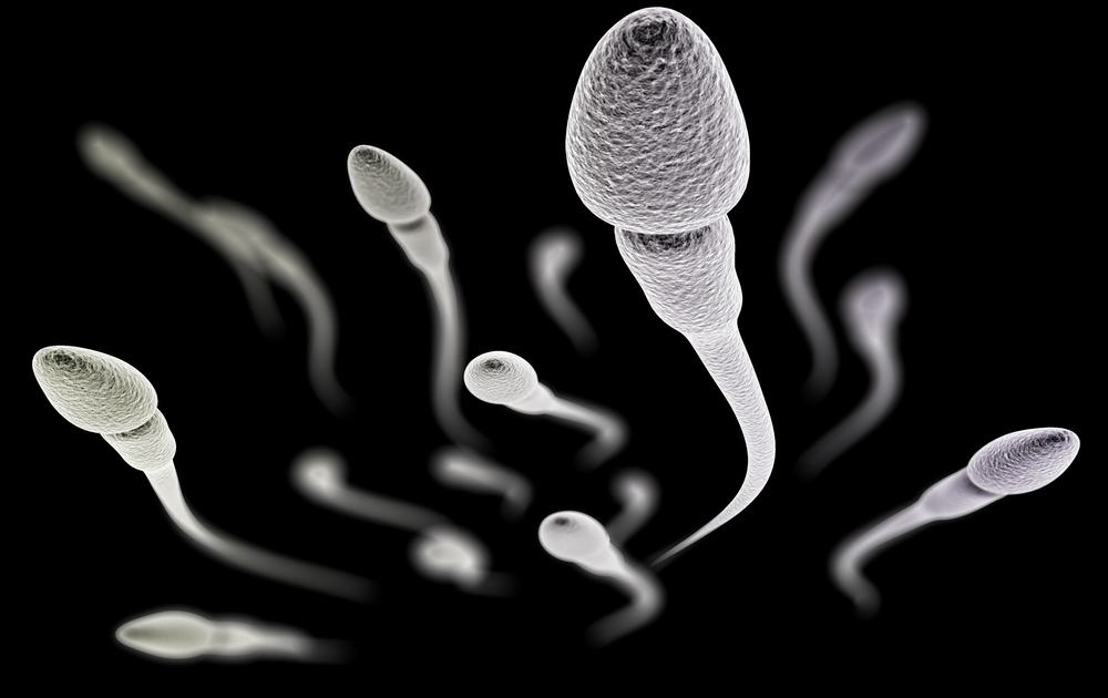 da cosa deriva il colore dello sperma