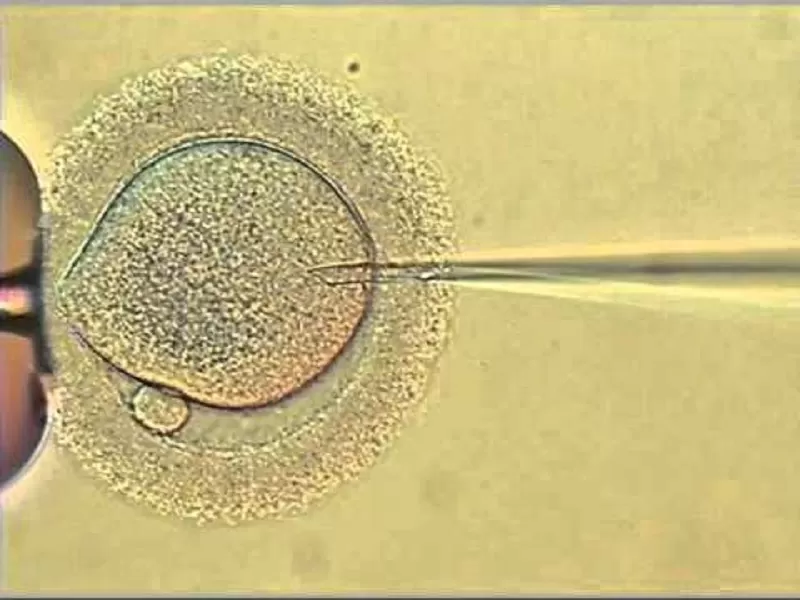 Icsi clinica fertilità Roma